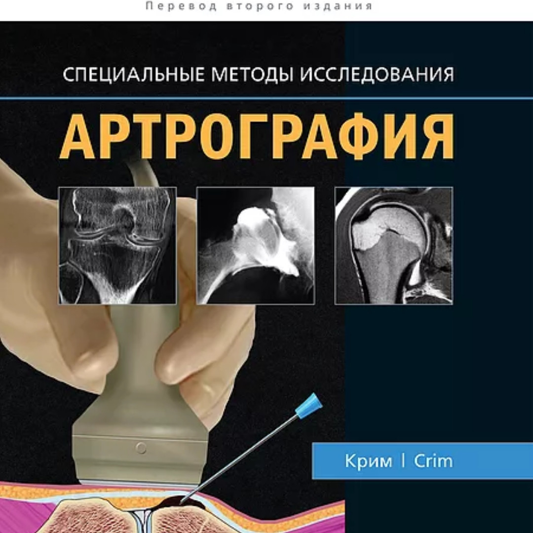 

Крим Р. Дж. Артрография узи (978-5-91839-110-5) Изд. Издательство Панфилова