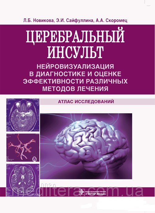 

Новикова Л.Б., Сайфуллина Э.И., Скоромец А.А. Церебральный инсульт (978-5-9704-2187-1) Изд. ГЭОТАР-Медиа