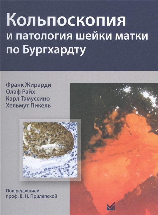 

Жирарди Ф. Кольпоскопия и патология шейки матки по Бургхардту (978-5-00030-556-0) Изд. МЕДпресс-информ