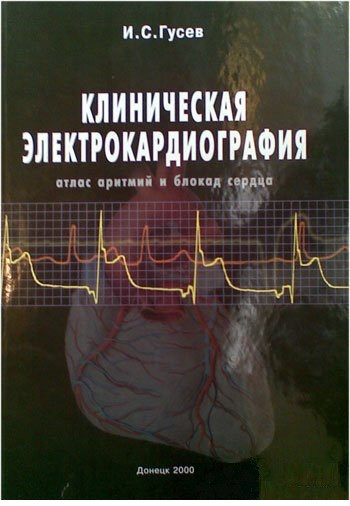 

Гусев И.С. Клиническая электрокардиография. Атлас аритмий и блокад сердца (966-7904-13-Х) Изд. Более другое