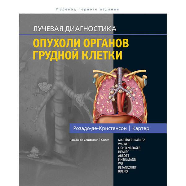 

Розадо-де-Кристенсон М.Л., Картер Б.В. Лучевая диагностика. Опухоли органов грудной клетки 2018 (978-5-91839-093-1) Изд. Издательство Панфилова