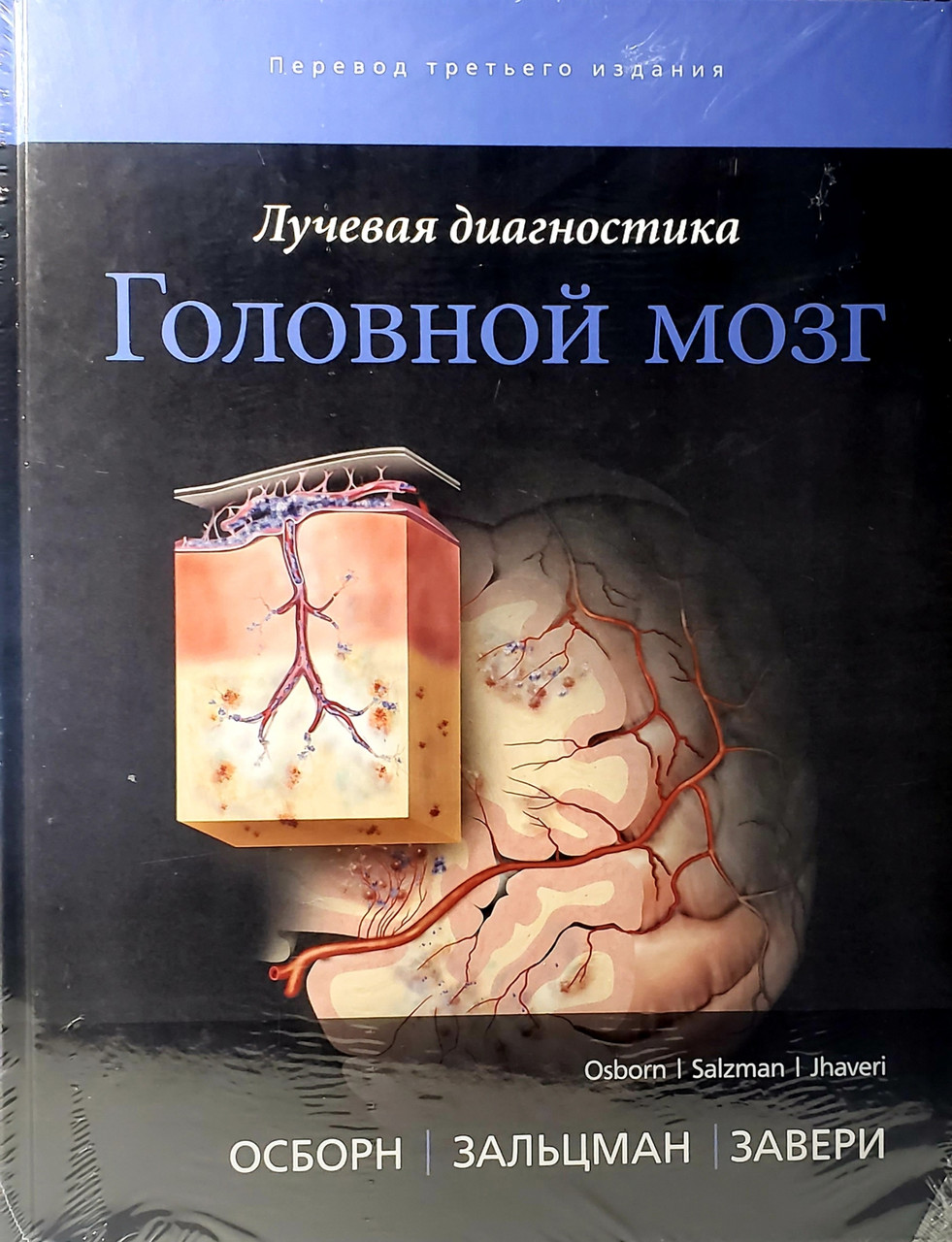 

Осборн А.Г., Зальцман К.Л., Завери М.Д. Лучевая диагностика. Головной мозг Иллюстрированное руководство (978-5-91839-097-9) Изд. Издательство Панфилова