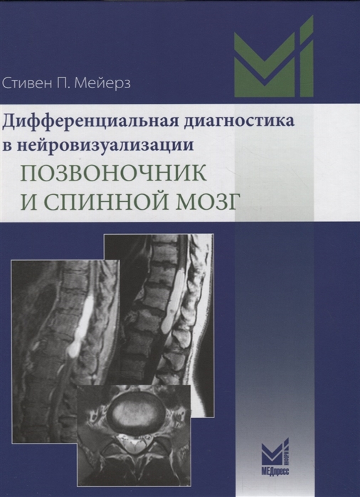 

Дифференциальная диагностика в нейровизуализации. Позвоночник и спинной мозг