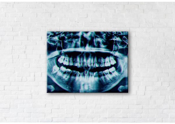 

Картина на холсте IBR X-ray Image 75x100 см