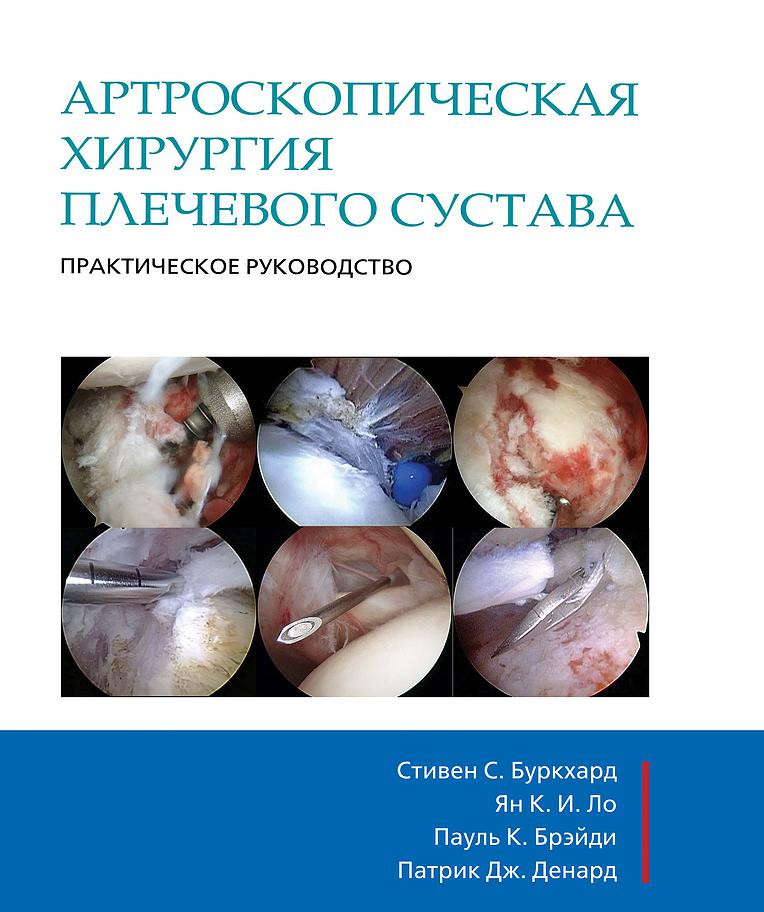 

Стивен С. Буркхард, Артроскопическая хирургия плечевого сустава. Практическое руководство (978-5-91839-054-2) Издательство Панфилова