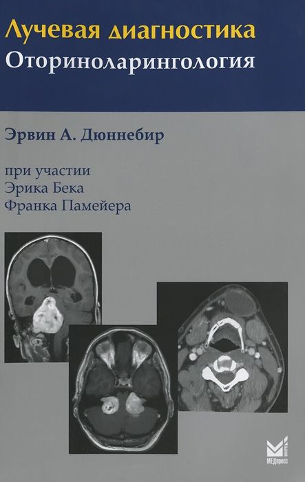 

Эрвин А. Дюннебир. Лучевая диагностика. Оториноларингология 3-е издание 2019 год (978-5-00030-671-0) Изд. МЕДпресс-информ