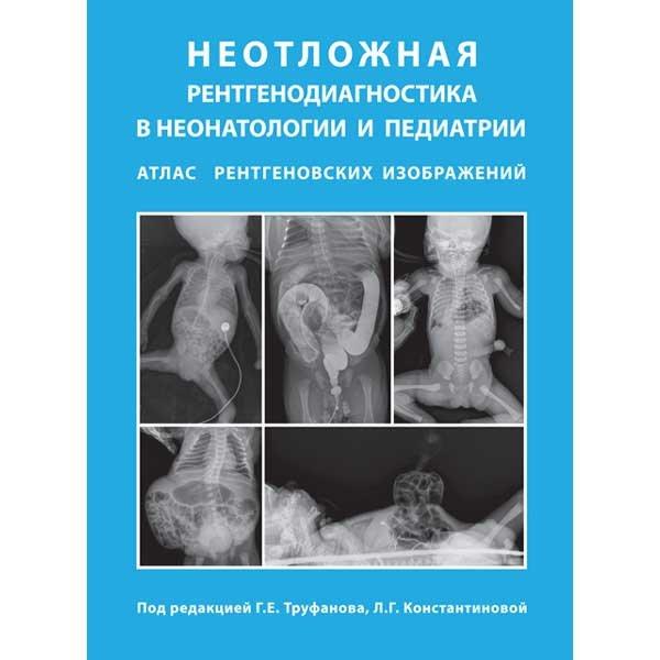 

Труфанов Г.Е. Неотложная рентгенодиагностика в неонатологии и педиатрии (Атлас рентгеновских изображений) (978-5-6042515-7-7) Изд. Бином