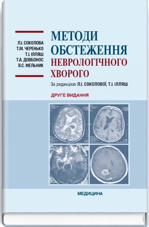 

Соколова Л.І. Черенько Т.М. Методи обстеження неврологічного хворого. (978-617-505-793-3) Изд. Медицина