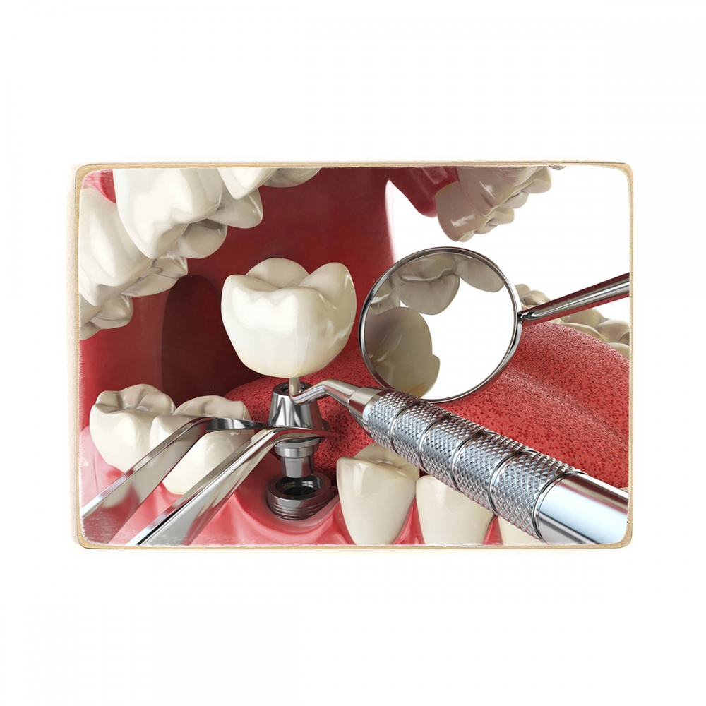 

Деревянный постер Стоматология Dental Implant А2