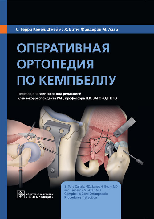 

Кэнел С.Т., Бити Дж.Х., Азар Ф.М. Оперативная ортопедия по Кемпбеллу 2021 год