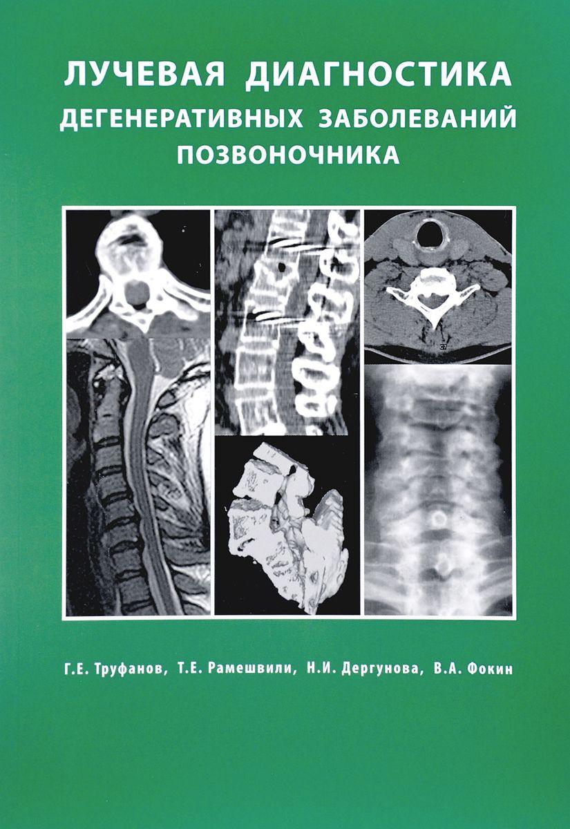 

Труфанов Г.Е. Лучевая диагностика дегенеративных заболеваний позвоночника (3-е издание)
