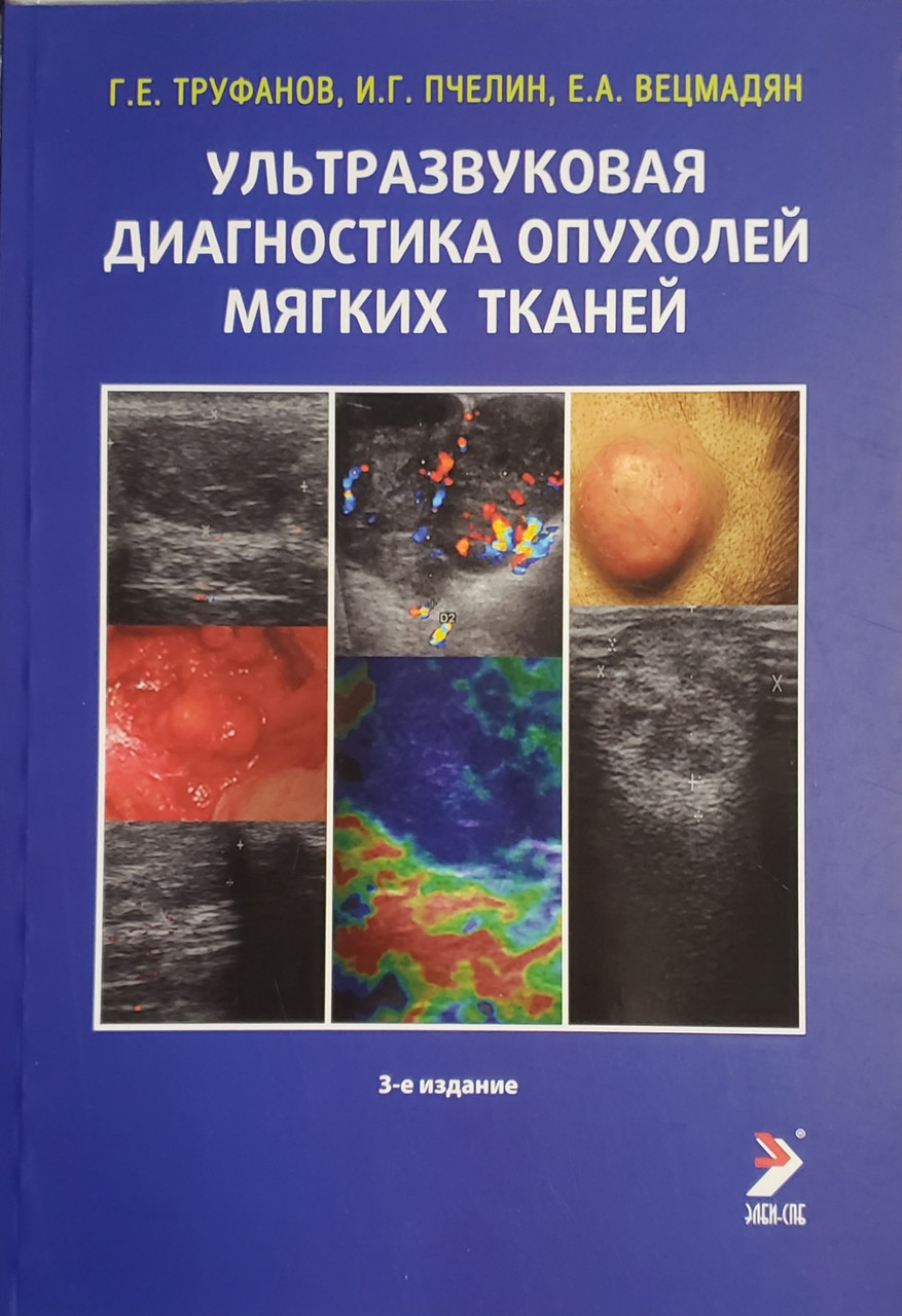 

Труфанов Г.Е. Ультразвуковая диагностика опухолей мягких тканей- 3-е издание