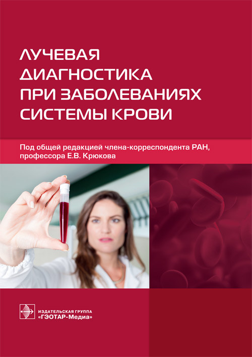

Лучевая диагностика при заболеваниях системы крови под общ. ред. Е. В. Крюкова. Москва 978-5-9704-6333-8 Изд. ГЭОТАР-Медиа