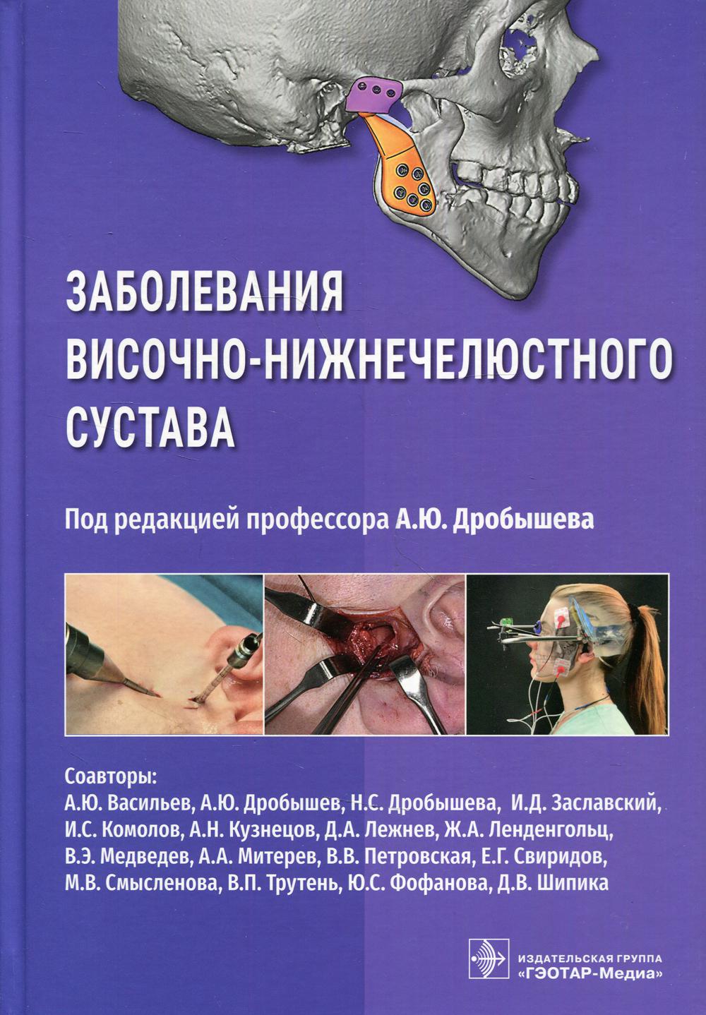 

Заболевания височно-нижнечелюстного сустава