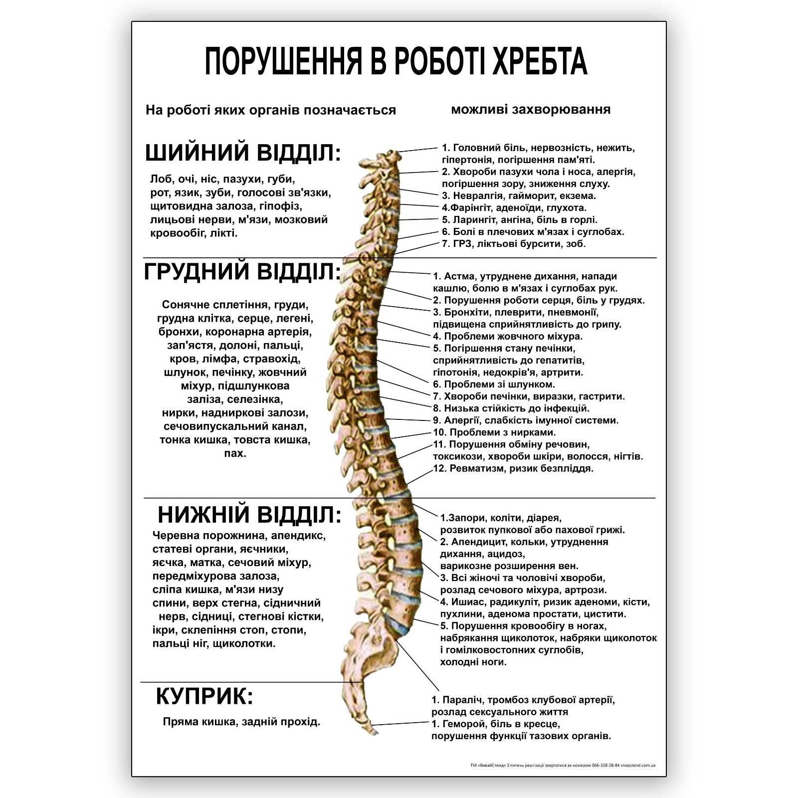 

Плакат Beauty Special “Порушення в роботі хребта” А0 (a8224c-25387-3)