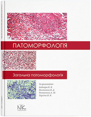 

Патоморфологія. Загальна патоморфологія. Боднар Я. Я. та інші