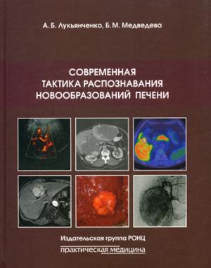

Современная тактика распознавания новообразований печени. Руководство