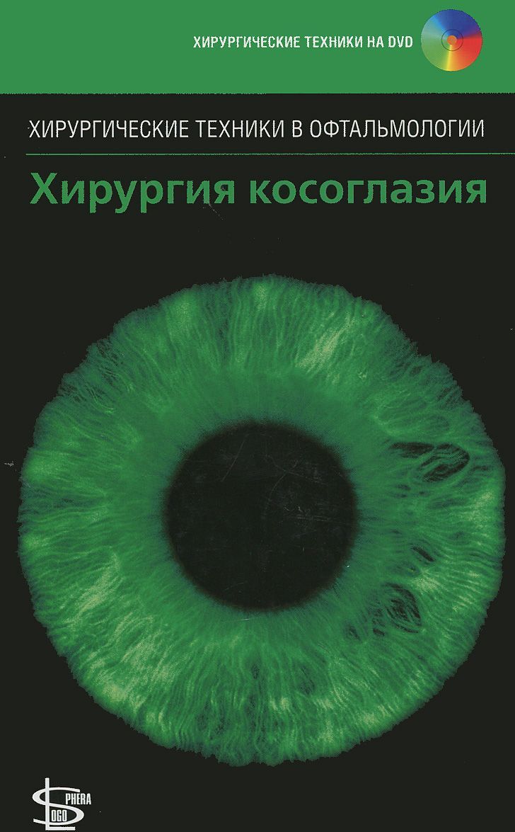

Хирургия косоглазия (+ DVD-ROM)