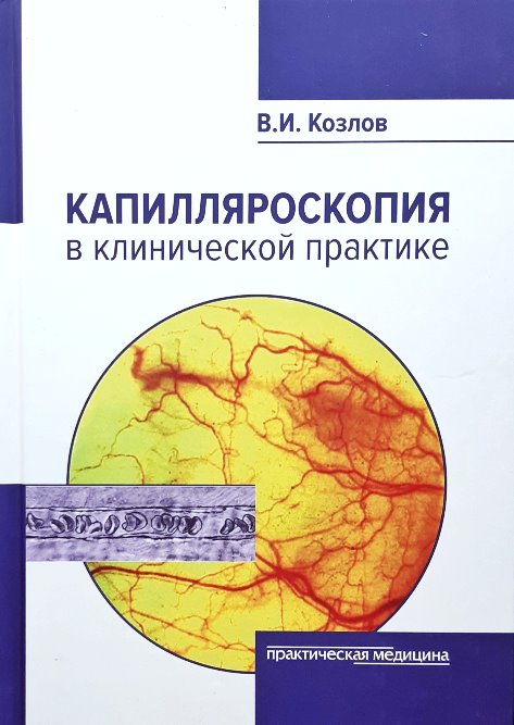 

Капилляроскопия в клинической практике