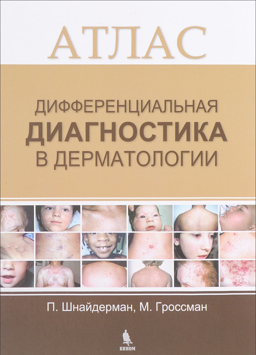 

Дифференциальная диагностика в дерматологии. Атлас