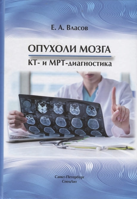 

Опухоли мозга КТ- и МРТ- диагностика