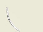 Эндотрахеальные трубки Flexicare для интубации трахеи обычные без манжеты ротовые/носовые размер 2.5 - изображение 1