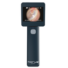 Отоскоп цифровий MIIS EOC100 Horus Digital Otoscope Full HD для діагностики слухового каналу (mpm_00255) - зображення 1