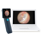 Отоскоп цифровий MIIS EOC100 Horus Digital Otoscope Full HD для діагностики слухового каналу (mpm_00255) - зображення 3