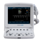 Ультразвуковая диагностическая система Edan U50 Prime Edition - изображение 3