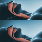 Клипса антихрап для носа Аnti snoring Голубая (М-11078) - изображение 4