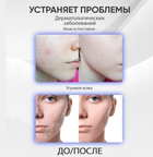 Дарсонваль косметологический для ухода за кожей лица волос и тела MASHELE BROM Darsonval YL-D04 газ Ar+Ne - изображение 9