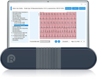 Монітор здоров'я серця зі штучним інтелектом Wellue - зображення 1