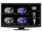 Клінічний медичний монітор JUSHA-CR22 (2МП, кольоровий, діагональ 21,5 дюйми, CT, MR, PET, PACS, ультразвук) - изображение 1
