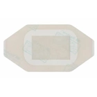 Пленочная повязка с неприлипающей подушечкой Tegaderm™ + Pad 3582 (5 x 7 см) - изображение 2