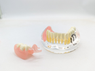 Модель стоматологічна імплантація та знімне протезування фантом - зображення 3