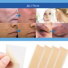 Силіконовий пластир від шрамів та рубців Ariella (4 листи) - зображення 6