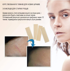 Силиконовый пластырь от шрамов и рубцов Aroamas Advanced Silicone Scar Sheets (4 листа 150х40 мм) - изображение 3