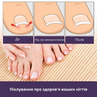 Набір пластирів Elastic Toenail Correction Sticker для безболісної корекції врослих нігтів (50 шт.) 9388-3 - зображення 4
