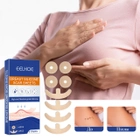 Силіконовий пластир для грудей від рубців Breast Silicone Scar Sheets - зображення 7