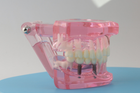 Модель стоматологічна демонстраційна (розбірна) рожева - зображення 5