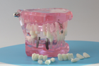 Модель стоматологічна демонстраційна (розбірна) рожева - зображення 8