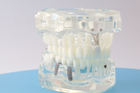 Модель стоматологічна демонстраційна - изображение 4