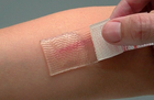 Силіконовий гелевий пластир для лікування шрамів та рубців CICA-CARE (6х12 см) - зображення 4