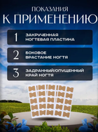 Наклейки тейпи коректори від Вростання Нігтя при деформації нігтьової пластини набір пластирів 50 шт (NST)2ф - зображення 4